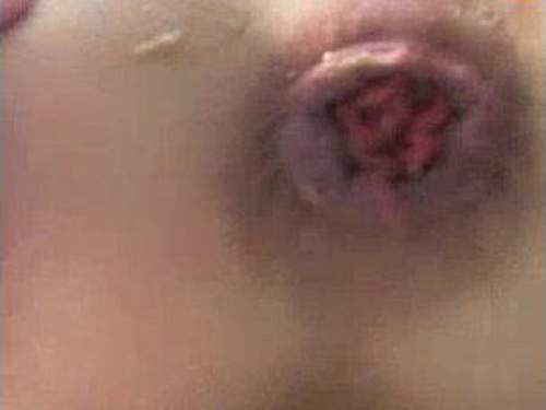 More webcam girl double penetration and big rosebud anus