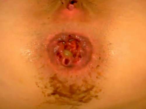 Young teen shitting anal rosebutt and gape loose closeup