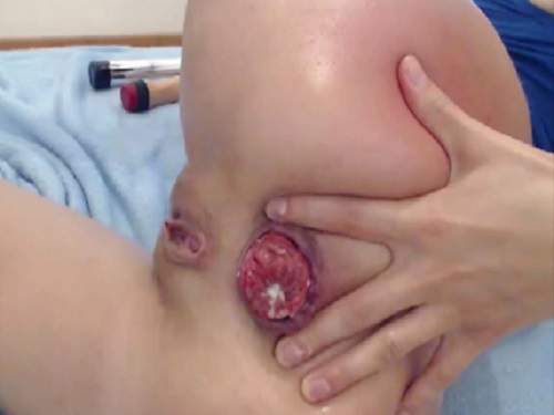Stunning rectal prolapse booty slut webcam