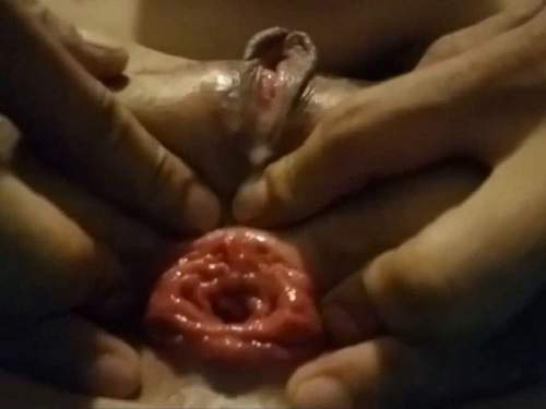Closeup – SexxxySammy teen prolapse – old vid shot with potato