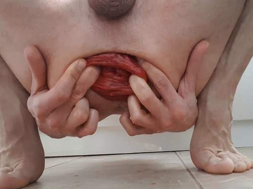 Anal prolapse – Amateur male hardcore stretching his giant anal prolapse