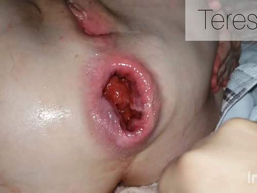 Closeup – Teresafilosofa again ruined anal rosebutt during fisting sex POV with husband