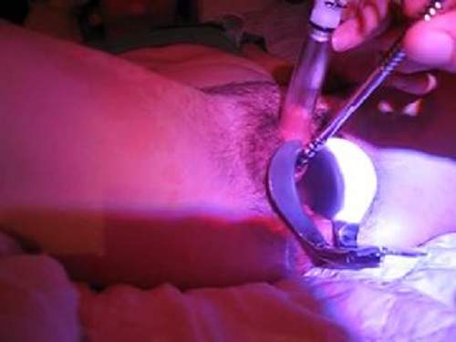 Big clit – Amazing mature clitoris pumping and urethra insertion