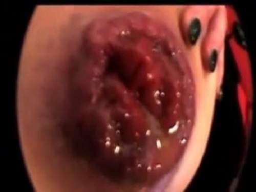 Gape ass – Unique mature homemade training her epic size prolapse anus