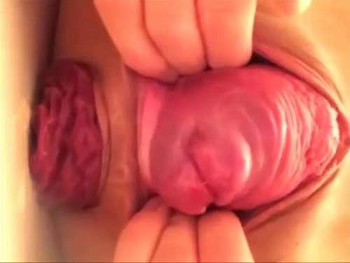 Prolapse porn – Amateur Japanese girl again stretching her huge prolapse and monster cervix