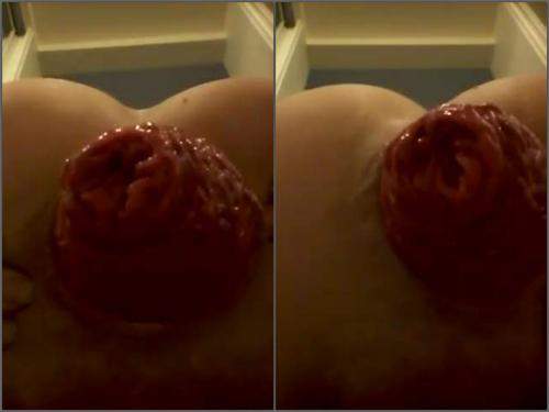 Amateur – Fantastic closeup amateur big ass girl games with her monster anal prolapse