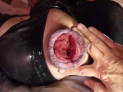 Gay fisting – Gays extremely anal prolapse porn during fisting sex homemade POV