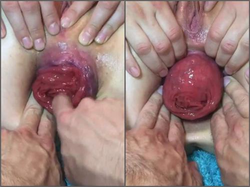 Prolapse ass – Tawney Mae POV show her giant anal prolapse very close-up