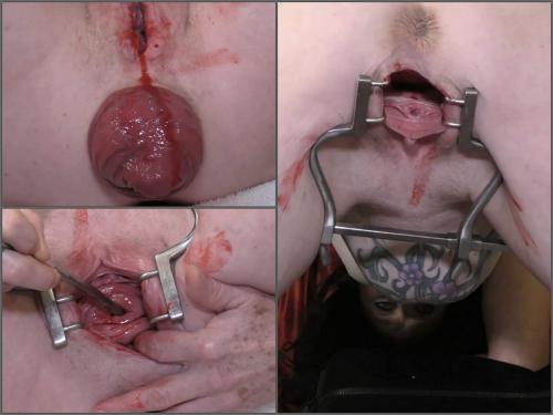 Speculum pussy – Bloody period speculum examination with dirty brunette