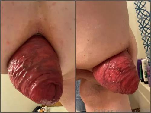 Amateur – Fatty pornstar Solag1998 sexy anal prolapse loose POV amateur