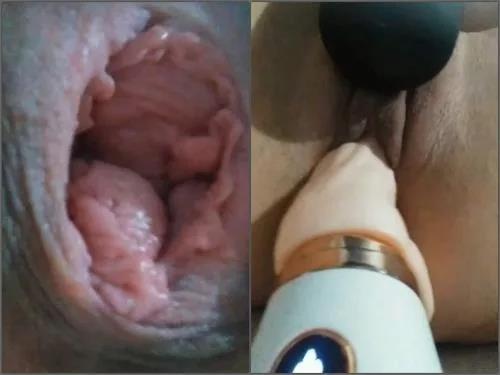Pussy prolapse – Large labia wife very close-up show pucker anal and dildos penetration