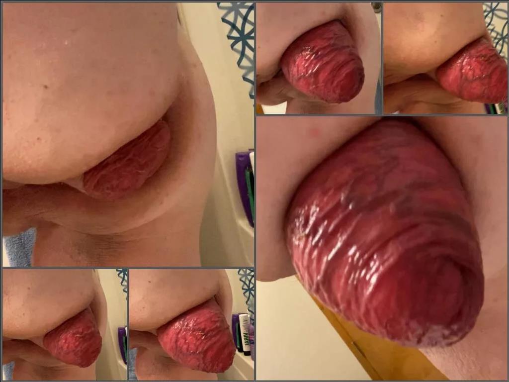 Solag1998 anal prolapse,Solag1998 prolapse porn,anal stretching,huge anal prolapse,girl anal xxx,girl anal porn,stretching big asshole,fatty pornstar,toilet fetish,bathroom porn
