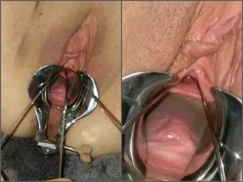 Bbw – Amateur POV medical fetish porn with hot wife Urethral_Play