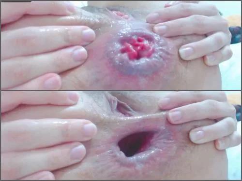 Anal insertion – Crazy latina Khloe_sr hard stretching anal rosebutt and big gape
