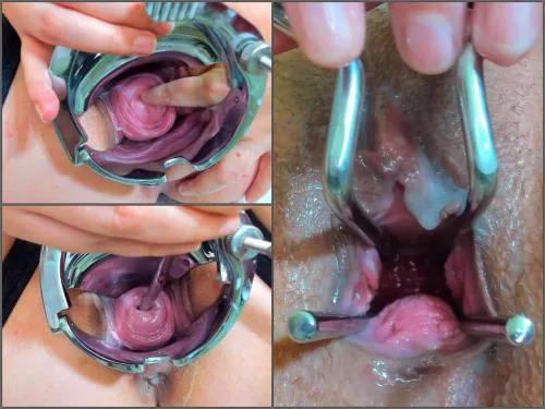 Cervix – Andradahot Medical Inspection inside my Cervix closeup – Premium user Request
