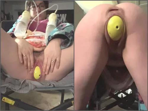 Hairy pussy – Hairy fatty pornstar QueenOfStretch nipples pump during vaginal terror