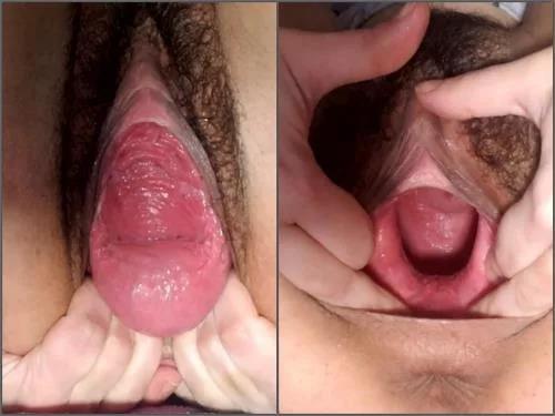 Webcam – Dirty hairy teen Vixenxmoon penetration tunnel plug in pussy prolapse