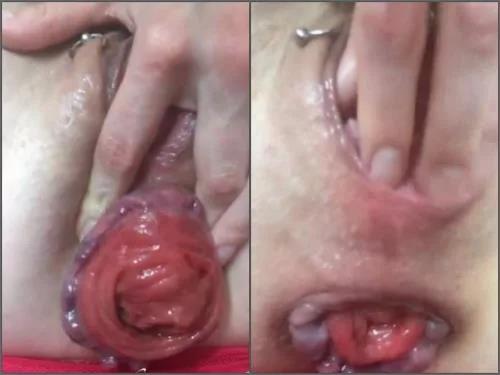 Prolapse porn – Natus Amare Shameless slut stretches her meaty prolapsing holes webcam