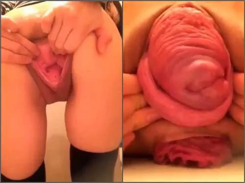 Pussy prolapse – Amazing compilation with huge pussy and anal prolapse stretching from japanese girl