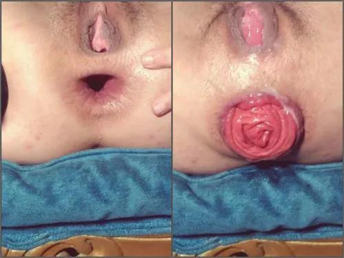 Fingering – Perverted girl Vixenxmoon fingering her beautiful anal prolapse
